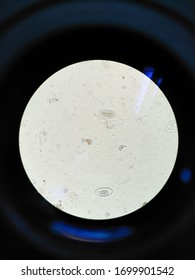 Enterobius Vermicularis Egg In Stool