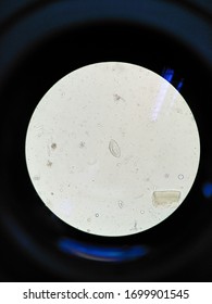 Enterobius Vermicularis Egg In Stool