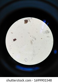 Enterobius Vermicularis Egg In Stool