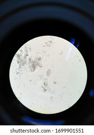 Enterobius Vermicularis Egg In Stool