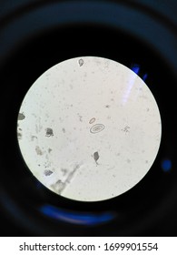 Enterobius Vermicularis Egg In Stool