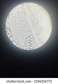 Enterobius Vermicularis Eggs In Stool 