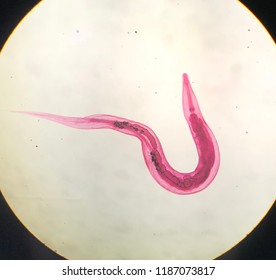 gambar enterobius vermicularis