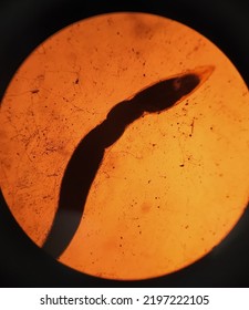 Enterobius Vermicularis Under Microscope 100x. Human Parasite. 