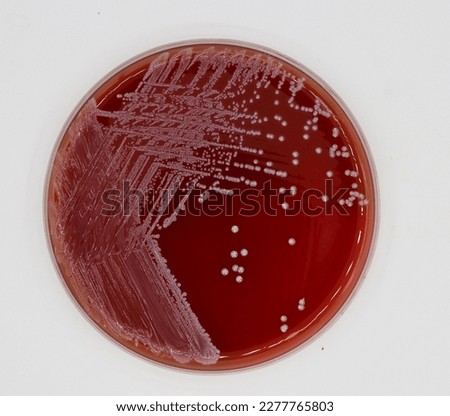 Enterococcus faecalis growing in blood agar