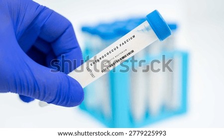 Enterococcus faecium Probiotic bacterium Used in probiotic formulations for gut health.