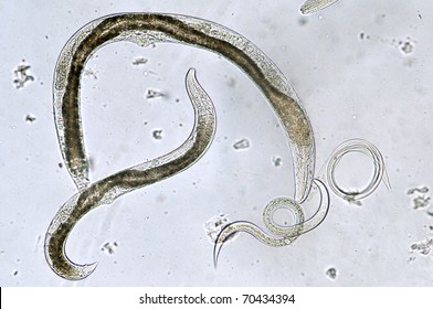 Entomopathogenic Nematodes - Females And Invasive Juvenile