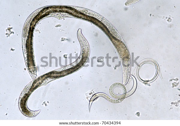 Entomopathogenic nematodes - females and\
invasive\
juvenile