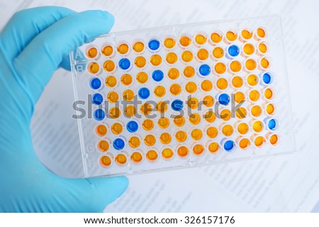 Enzyme-linked immunosorbent assay (ELISA), Immunology testing method in laboratory
