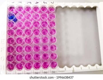 Enzyme-linked Immunosorbent Assay (ELISA) Plate, Immunology Or Serology Testing Method In Medical Laboratory,Anti HCV Test