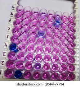 Enzyme-linked Immunosorbent Assay (ELISA) Plate, Immunology Or Serology Testing Method In Medical Laboratory, HCV Test, Show Some Positive Result