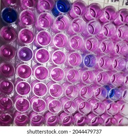 Enzyme-linked Immunosorbent Assay (ELISA) Plate, Immunology Or Serology Testing Method In Medical Laboratory, HCV Test, Show Some Positive Result