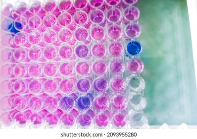 Enzyme-linked Immunosorbent Assay (ELISA) Plate, Anti HCV Test, TPHA Test, HBsAg Test, Show Some Positive Result, Close View