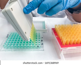 Enzyme-linked Immunosorbent Assay (ELISA) Test Used  Diagnostic Tool In Medicine, Plant Pathology 