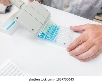 Enzyme-linked Immunosorbent Assay (ELISA) Test Used  Diagnostic Tool In Medicine, Plant Pathology 