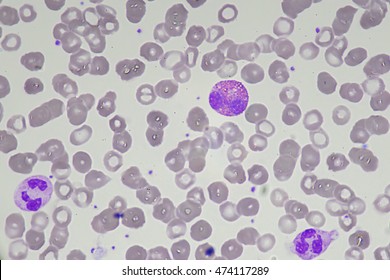 Basophil Blood Smear Hematology Stock Photo (Edit Now) 1017866086