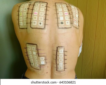 480 Skin patch test Images, Stock Photos & Vectors | Shutterstock