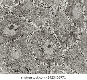 Epidermis spinous layer. The keratinocytes show polygonal shapes, central nucleus with nucleolus, cytoplasm full of keratin filament bundles, and numerous desmosomes crossing the intercellular spaces