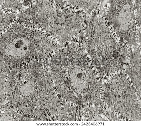 Epidermis spinous layer. The keratinocytes show polygonal shapes, central nucleus with nucleolus, cytoplasm full of keratin filament bundles, and numerous desmosomes crossing the intercellular spaces