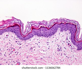 Epidermis of the thin skin. It can be identified the stratum basale, spinosum, a narrow stratum granulosum and a superficial well defined stratum corneum. The epidermis rest over the dermis.