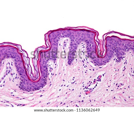 Epidermis of the thin skin. It can be identified the stratum basale, spinosum, a narrow stratum granulosum and a superficial well defined stratum corneum. The epidermis rest over the dermis.