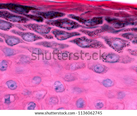 Epidermis of thin skin. Detail of keratinocytes of the stratum spinosum and granulosum (showing numerous granules of keratohyalin).
