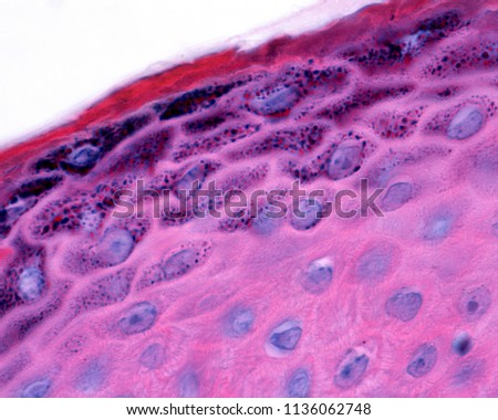 Epidermis of thin skin. Detail of keratinocytes of the stratum granulosum with numerous granules of keratohyalin.