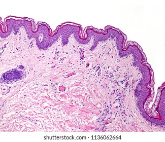 Epidermis of the thin skin, resting over the dermis. On the surface of the epidermis the stratum corneum is identified.