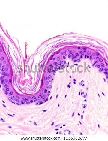Epidermis of the thin skin showing the stratum basale, very narrow stratum spinosum and granulosum and a superficial well defined stratum corneum. The epidermis rest over the dermis.
