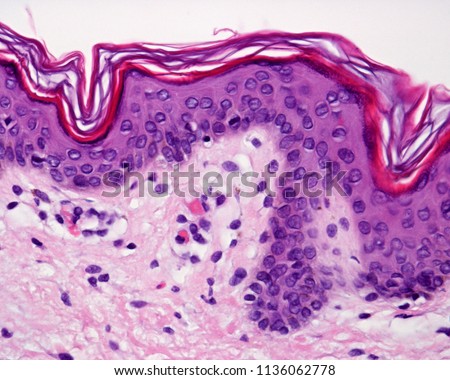 Epidermis of the thin skin, showing: the stratum basale (with a metaphase in the center of the image), spinosum, a narrow stratum granulosum and a superficial well defined stratum corneum. 