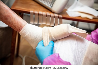 Epidermolysis bullosa, nurse bandage the foot, Butterfly children or EB disease - Shutterstock ID 2218252507