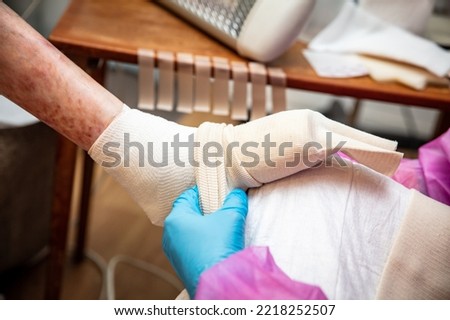 Epidermolysis bullosa, nurse bandage the foot, Butterfly children or EB disease