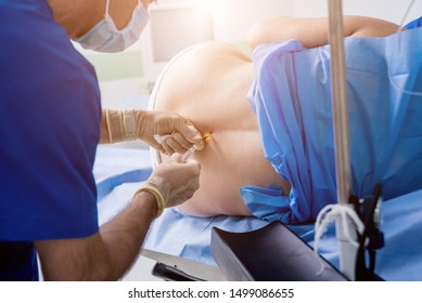 Epidural Anesthesia Injections. Prepare For Surgery. Medical Background