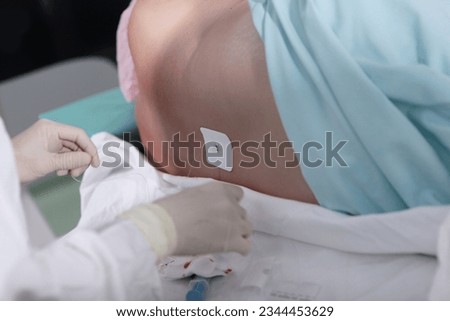 Epidural anesthesia.Installation of a catheter. Blockage of the spinal nerve.Preparation for the operation.Close-up. Stock foto © 