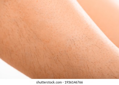腕の小さな白い斑点 特発性ゲンマ病 老人の皮膚の肝斑点 によく似た画像 写真素材 ベクター画像 Shutterstock