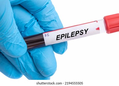 Epilepsy. Epilepsy Disease Blood Test In Doctor Hand