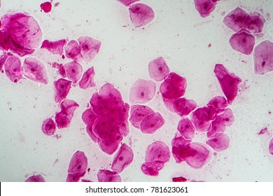 Epithelial Cells Bacteria Oral Cavity Stock Photo 781623061 | Shutterstock