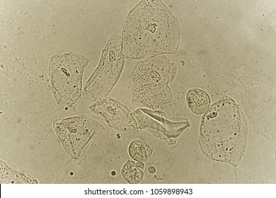 657 White Blood Cell Urine Images, Stock Photos & Vectors | Shutterstock