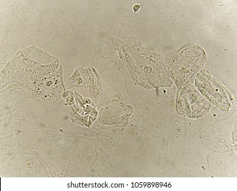 Epithelial Cells Bacteria Patient Urine Urinary Stock Photo 1059898946 