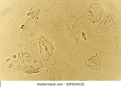 Epithelial Images, Stock Photos & Vectors | Shutterstock