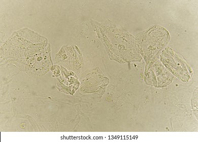 Epithelial Cells Bacteria Patient Urine Urinary Stock Photo 1349115149 ...