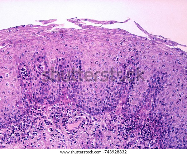 epithelial-lining-esophagus-nonkeratinized-stratified-squamous