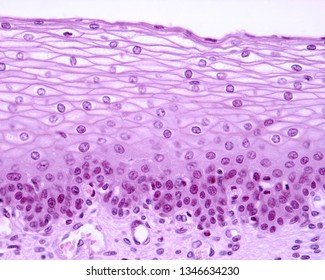 stratified squamous epithelium keratinized 400x