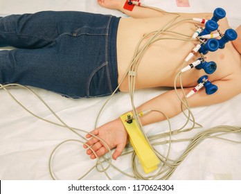 Equipment For Electrocardiograms, Cardiogram For A Child. ECG Sensors On The Child's Body.