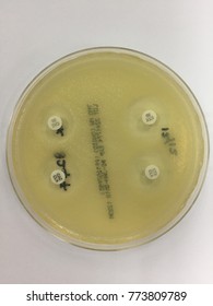 ESBL ( Extended Spectrum Beta Lactamase )