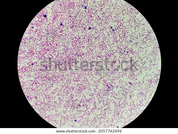 Escherichia coli bacterium, E.coli,\
gram-negative rod-shaped bacteria, part of intestinal normal flora\
and causative agent of diarrhea and inflammations of different\
location. Close up\
micrograph.