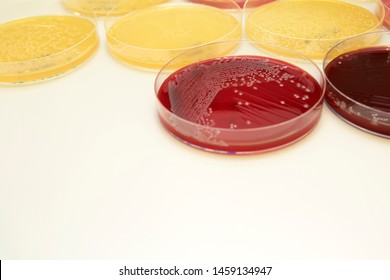 Escherichia Coli E Coli Culture Petri Shutterstock