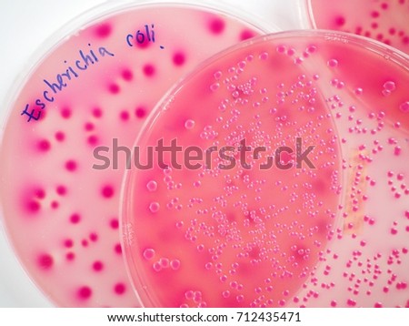 Escherichia coli (E. Coli) are growth on the selective agar with pink or red colonies