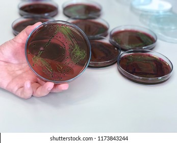 Escherichia Coli (E.coli) Cultured With Eosin Methylene Blue (EMB) Agar In Petri Dish Show The Metallic Green Sheen Colonies Using Biological Safety Cabinets In Medical Health Lab For Analysis Disease