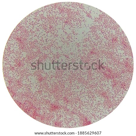 Escherichia coli, fecal coliform bacteria .its normal flora in human. E.coli rod-cocci shape,gram negative , from gram stain  under the microscope 